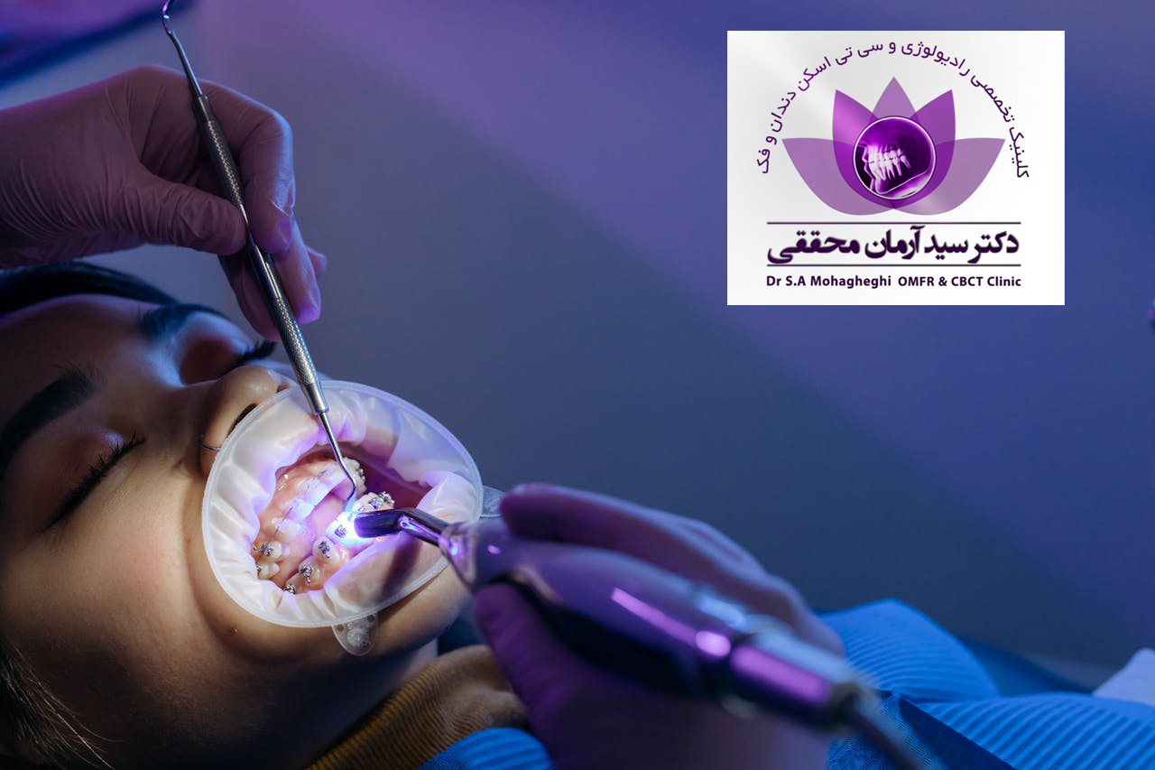 انواع ارتودنسی: کدام روش برای شما مناسب‌تر است؟