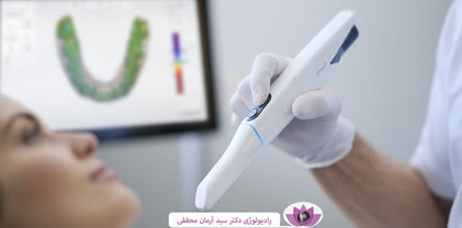 اسکنر داخل دهانی: تکنولوژی پیشرفته در خدمت دندانپزشکی مدرن
