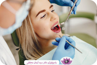 آیا برای انجام ارتودنسی باید دندان عقل را کشید؟